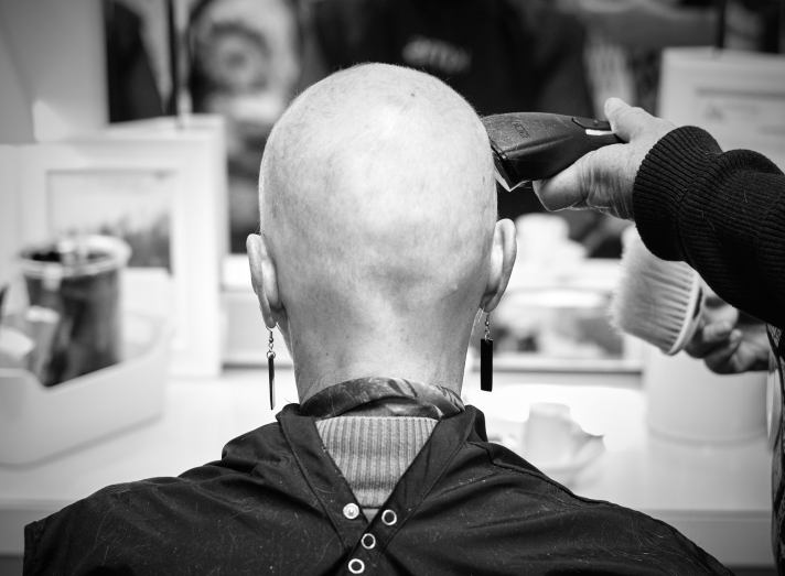 Photo of the back of a bald head having the hair cut